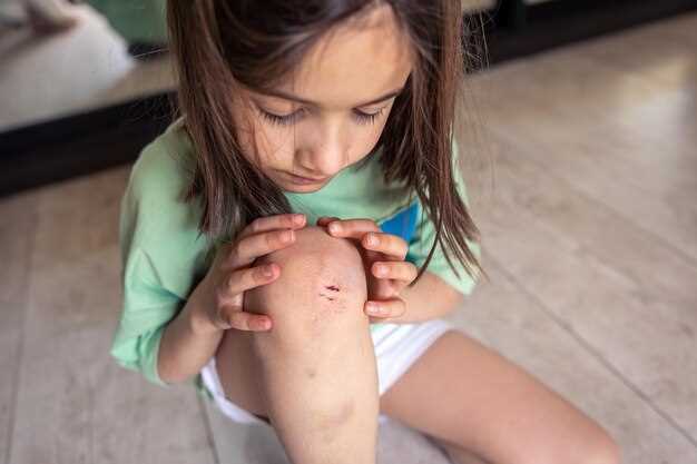 Бородавка на ноге у ребенка: симптомы и причины