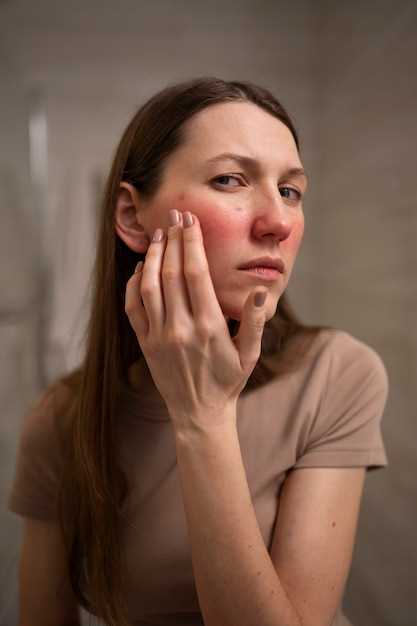 Косметологические процедуры для сокращения шрамов после акне