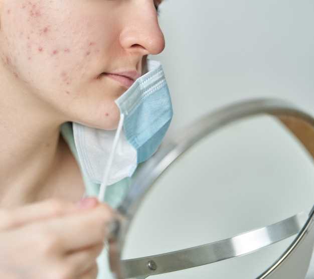 Избавление от лицевого клеща: основные способы устранения
