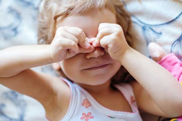 Методы лечения ячменя у двухлетнего ребенка