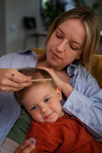 Натуральные способы лечения себорейного дерматита на голове у ребенка