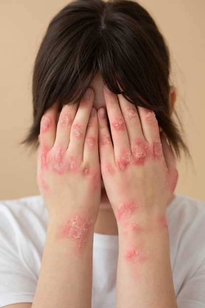 Симптомы и проявления аллергии
