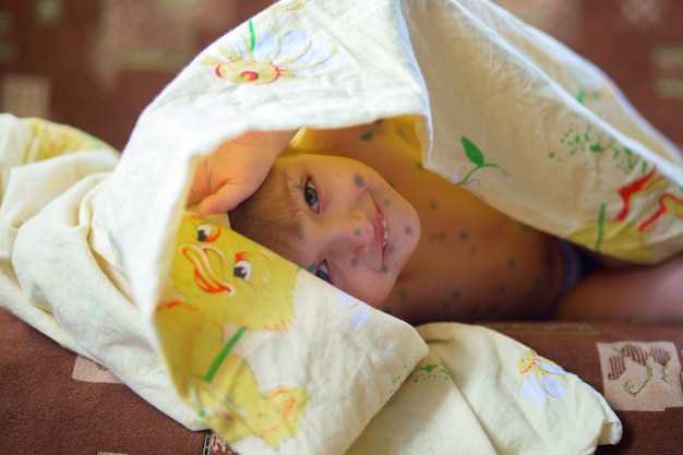 Влияние желтухи на здоровье младенцев