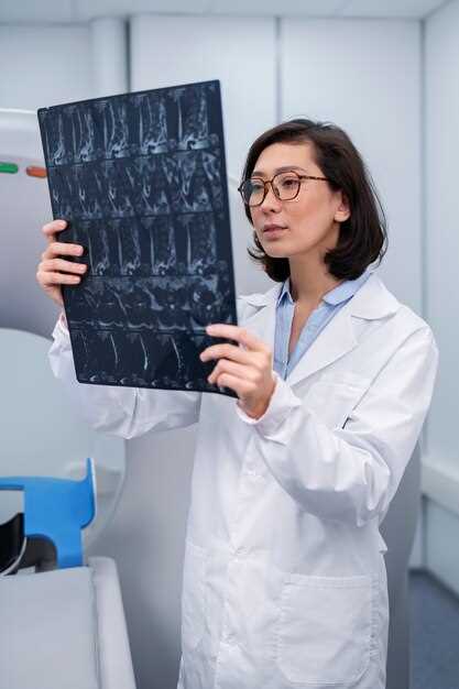 Как остеопороз проявляется на рентгеновских снимках