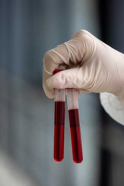 Важность общего анализа крови при выявлении заболеваний