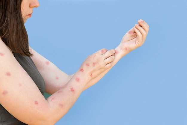 Лямблии и аллергическая реакция на коже