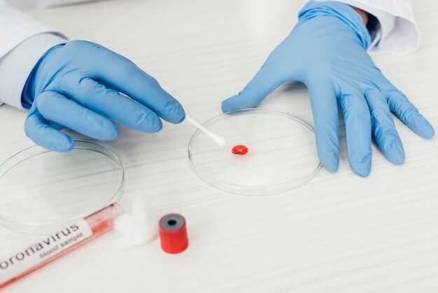 Уровень тромбоцитов: важный показатель состояния крови при подозрении на лейкоз