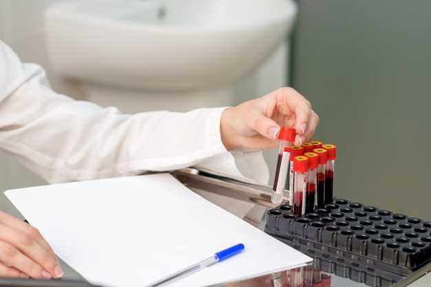 Ключевые аспекты анализа крови при воспалении легких