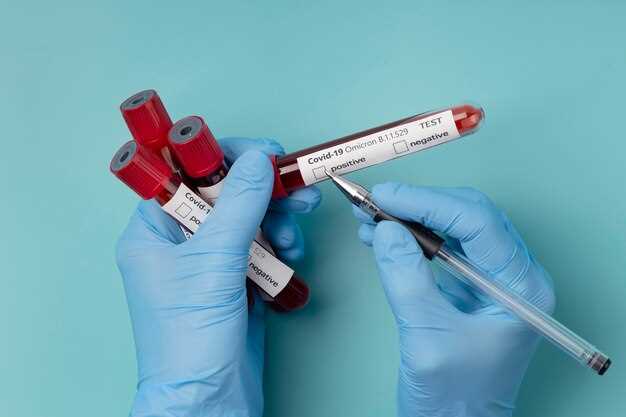 Процесс сдачи крови для анализов