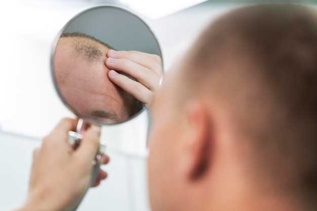 Как избавиться от перхоти в бороде: простые методы и средства