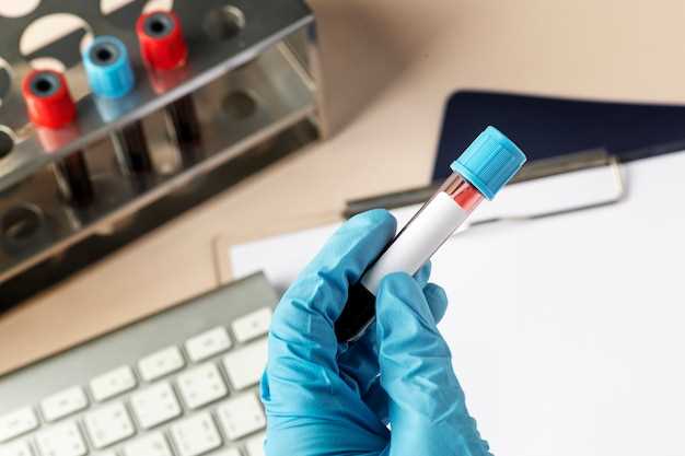 Важность анализа тромбоцитов для диагностики заболеваний и контроля состояния крови