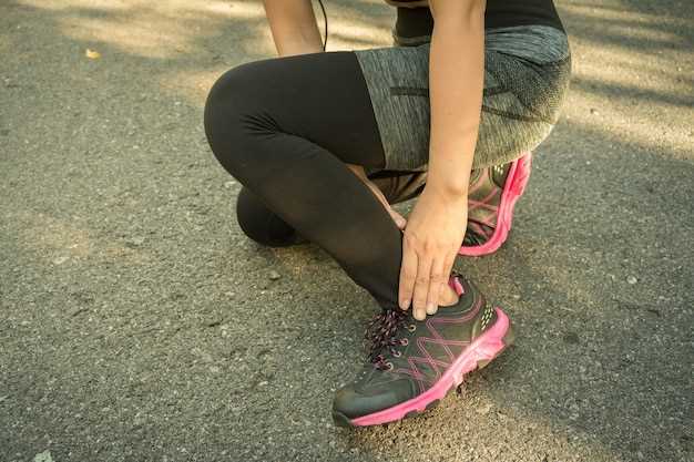 Симптомы и причины растяжения связок на ноге